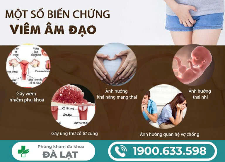 Hình ảnh minh họa